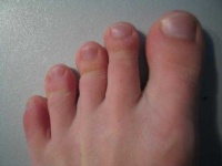 image of toe #33