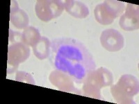 image of blood_cell