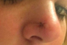 image of nose #14