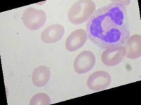 image of blood_cell