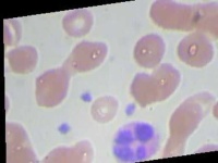 image of blood_cell