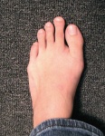 image of toe #7