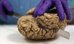 image of brain #1