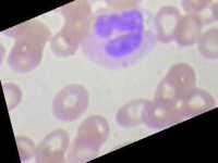 image of blood_cell