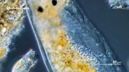 image of parasitic_flatworms