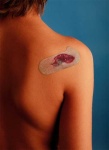 image of band_aid