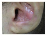 image of ear