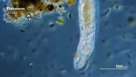 image of parasitic_flatworms