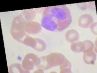 image of blood_cell