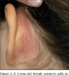 image of ear