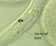 image of nematode