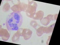 image of blood_cell