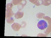 image of blood_cell