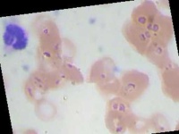image of blood_cell