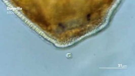 image of parasitic_flatworms