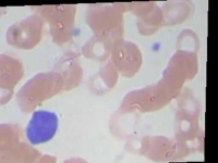 image of blood_cell