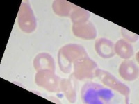 image of blood_cell