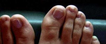 image of toe #13