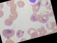 image of blood_cell