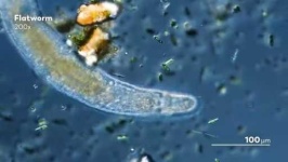 image of parasitic_flatworms