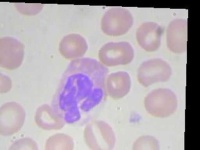 image of blood_cell