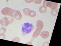 image of blood_cell