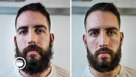 image of beard