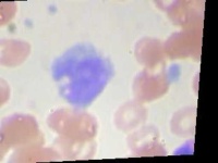 image of blood_cell