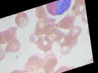 image of blood_cell