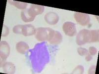 image of blood_cell
