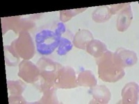 image of blood_cell