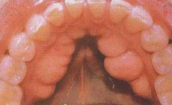 image of mouth #16