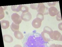 image of blood_cell