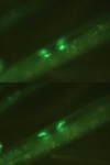 image of nematode