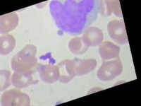 image of blood_cell