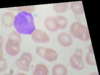 image of blood_cell