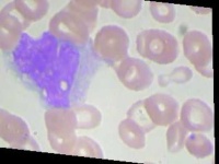 image of blood_cell