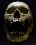 image of skull