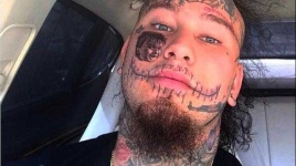 image of stitches