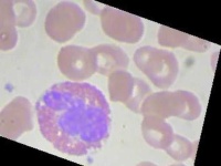image of blood_cell