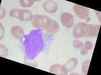 image of blood_cell