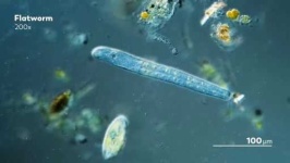 image of parasitic_flatworms