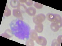 image of blood_cell