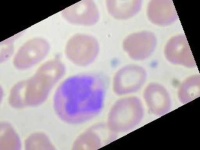 image of blood_cell