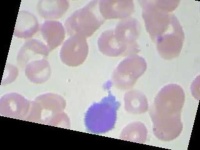 image of blood_cell