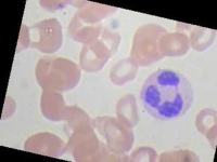 image of blood_cell