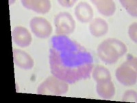 image of blood_cell