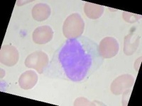 image of blood_cell