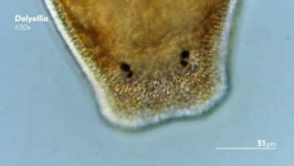 image of parasitic_flatworms