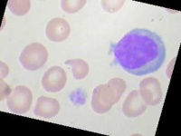 image of blood_cell